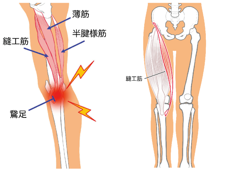 膝の痛み_膝関節痛